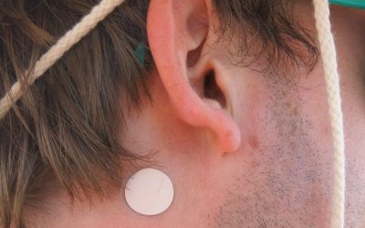 The “sea sickness patch”
